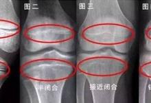 14歲男孩3年沒(méi)長(zhǎng)個(gè) 爸爸表態(tài):家有4套房 矮不用治