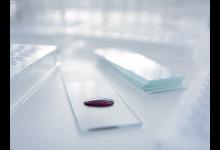 福州2歲男童吃變質咸鴨蛋嘔血休克 搶救8天才好轉