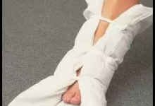 四川九寨溝縣發生7.0級地震,看圖學習骨折如何急救!