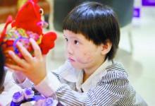 5歲女童店門口玩耍時遭惡犬狂咬 臉部血肉模糊