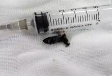 4歲寶寶睡覺打鼾,突然沒了呼吸!醫生從身上取出這東西……家長都長點心!