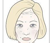 黑眼圈或是牛奶喝太多？臉色不好都是吃出來的！