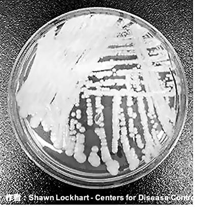 “超級真菌”肆虐全球 到底是背誰的鍋? “超級真菌”肆虐全球 到底是背誰的鍋?