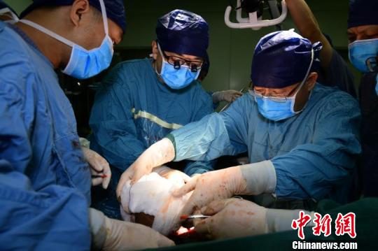 西安醫學專家利用磁輔助實施肝移植 創“無肝期”新紀錄