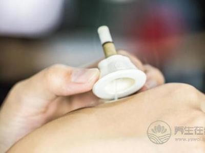 艾艾貼艾灸器:知名養生節目都在講它,連《向往的生活》里都有它