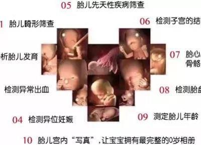 唐山寶島婦兒醫院:四維彩超檢查什么有哪些注意事項?