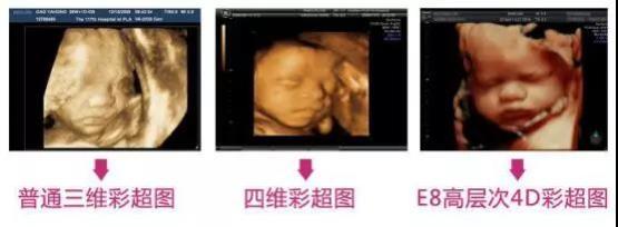 懷了雙胞胎又驚喜又擔憂,唐山寶島婦兒醫院為您保駕護航-易網健康養生網 懷了雙胞胎又驚喜又擔憂,唐山寶島婦兒醫院為您保駕護航