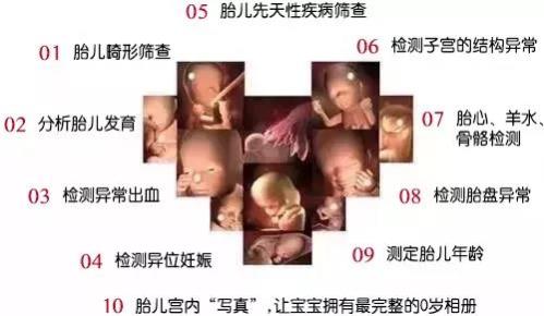 對四維彩超有疑惑，咨詢唐山寶島婦兒醫院