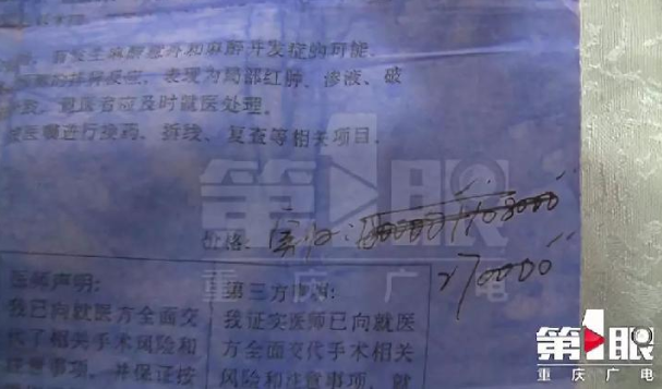 上海比華利整形醫(yī)院跟重慶某整形機構(gòu)存合作關(guān)系？整形失敗拒接受采訪