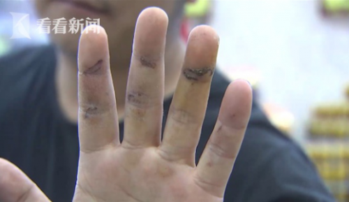 通州灣三余人民醫院為男病人配婦科用藥?院方:拿錯了-易網健康<a href=http://www.jsjjzhkt.cn/jkys/ target=_blank class=infotextkey>養生</a>網 通州灣三余人民醫院為男病人配婦科用藥?院方:拿錯了