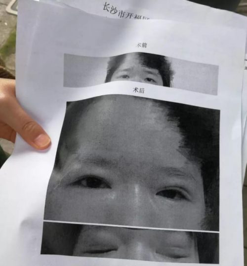 女碩士在長沙姬妍星愿整形醫(yī)院整形失敗怒告醫(yī)院追蹤-易網(wǎng)<a href=http://www.jsjjzhkt.cn/ target=_blank class=infotextkey>健康養(yǎng)生</a>網(wǎng) 女碩士在長沙姬妍星愿整形醫(yī)院整形失敗怒告醫(yī)院追蹤