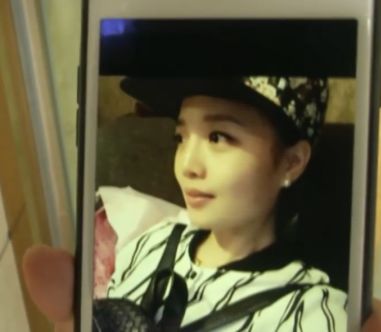 杭州美萊美容醫(yī)院把我鼻子做壞了 高價隆鼻后凹凸不平