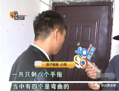 杭州余杭婦產醫(yī)院沒查出胎兒雙手畸形要不要擔責?B超能查胎兒畸形嗎?-易網<a href=http://www.jsjjzhkt.cn/ target=_blank class=infotextkey>健康養(yǎng)生</a>網 杭州余杭婦產醫(yī)院沒查出胎兒雙手畸形要不要擔責?B超能查胎兒畸形嗎?