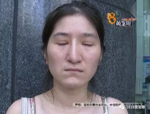 女子貸款四萬(wàn)多在杭州麗星國(guó)際整形做隆鼻不僅沒做好 工作也沒找到