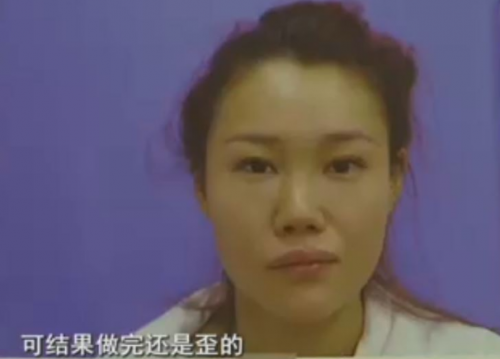 杭州格萊美整形醫院把美女鼻子成了S型 只敢開美顏拍照-易網健康<a href=http://www.jsjjzhkt.cn/jkys/ target=_blank class=infotextkey>養生</a>網 杭州格萊美整形醫院把美女鼻子成了S型 只敢開美顏拍照