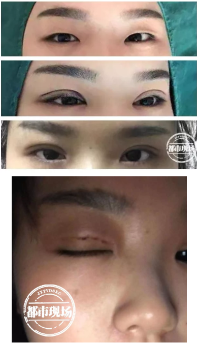 南昌愛玩美皮膚身材管理中心涉嫌無證行醫 女子花5800元整形失敗-易網健康<a href=http://www.jsjjzhkt.cn/jkys/ target=_blank class=infotextkey>養生</a>網 南昌愛玩美皮膚身材管理中心涉嫌無證行醫 女子花5800元整形失敗