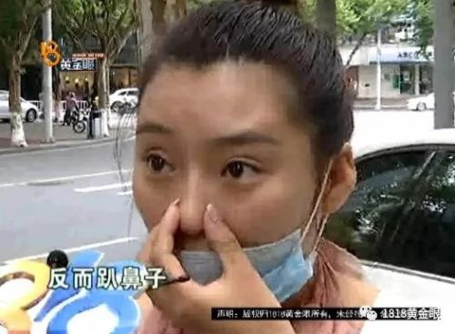 三女子整容均出現不同程度歪斜 義烏陽光美容醫院：本身就有問題