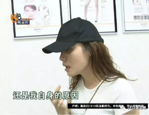 女子花4萬多在寧波首美整形美容醫(yī)院做鼻子 術(shù)后鼻子卻像被人打過