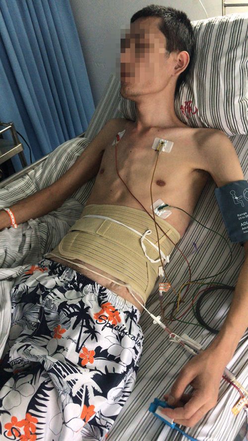 患者注射阿達木單抗注射液后感染肺結核 醫院:治療欠規范愿擔責三成-易網<a href=http://www.jsjjzhkt.cn/ target=_blank class=infotextkey>健康養生</a>網 患者注射阿達木單抗注射液后感染肺結核 醫院:治療欠規范愿擔責三成