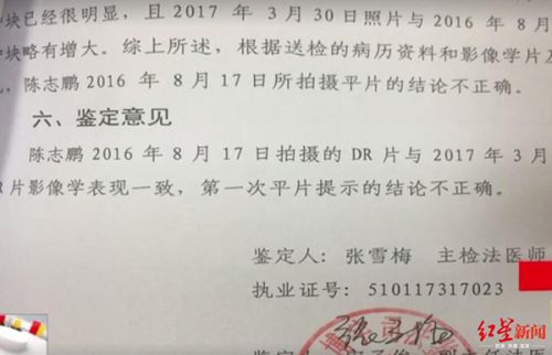 玉佩致胸片陰影誤診?四川勞研科技有限公司體檢顯示正常 男子一年后去世-易網(wǎng)健康養(yǎng)生網(wǎng) 玉佩致胸片陰影誤診?四川勞研科技有限公司體檢顯示正常 男子一年后去世