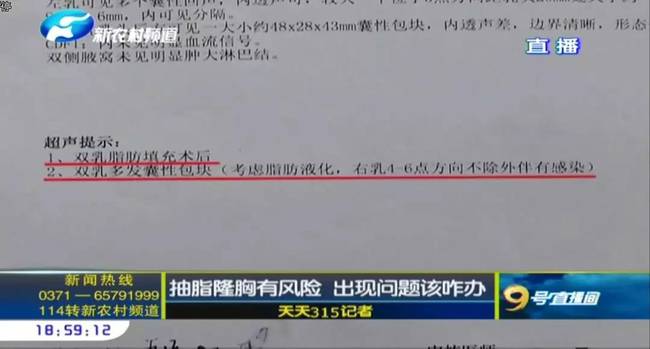 鄭州曹樂醫療整形:抽脂隆胸不靠譜 整出問題溝通難-易網健康養生網 鄭州曹樂醫療整形:抽脂隆胸不靠譜 整出問題溝通難