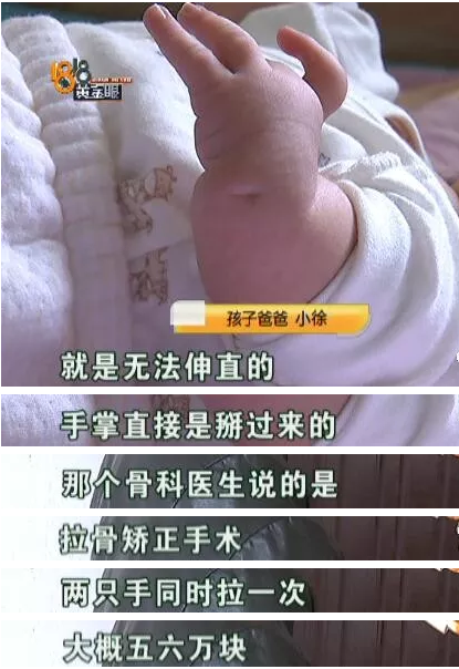 杭州余杭婦產醫(yī)院沒查出胎兒雙手畸形要不要擔責?B超能查胎兒畸形嗎?-易網健康養(yǎng)生網 杭州余杭婦產醫(yī)院沒查出胎兒雙手畸形要不要擔責?B超能查胎兒畸形嗎?