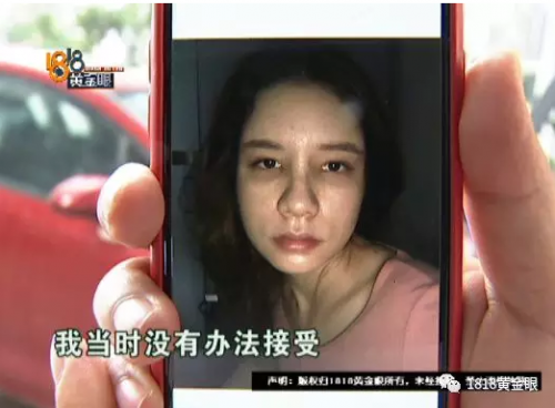 女子花4萬多在寧波首美整形美容醫(yī)院做鼻子 術(shù)后鼻子卻像被人打過