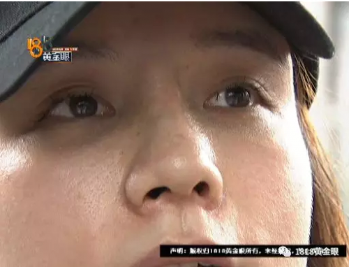 女子花4萬多在寧波首美整形美容醫(yī)院做鼻子 術(shù)后鼻子卻像被人打過