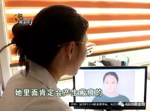 三女子整容均出現不同程度歪斜 義烏陽光美容醫院：本身就有問題