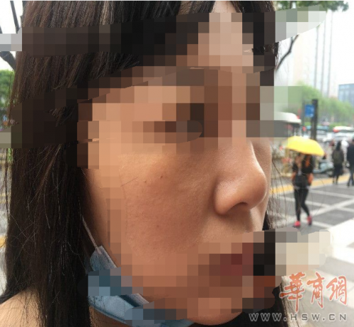 西安藝星美容整形醫院：醫美沒有統一標準 鼻子凹凸不平屬于正常