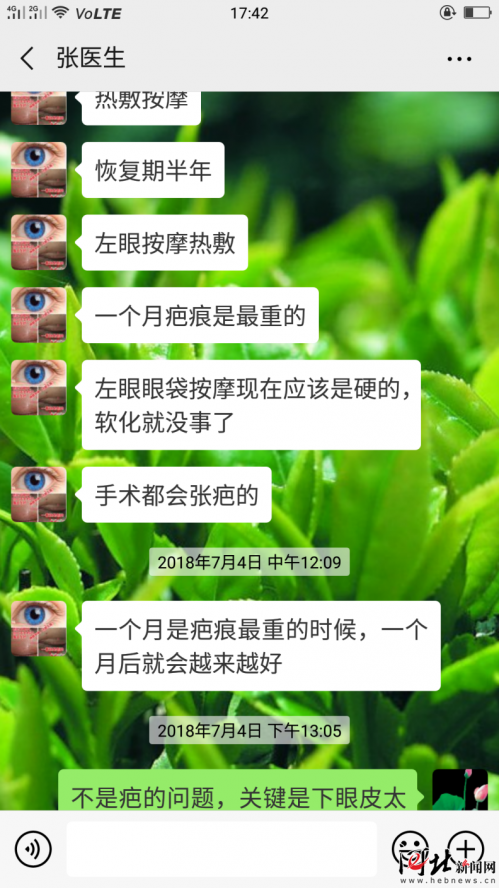 河北一女子在石家莊萬瑞醫療整形后眼睛閉不緊 醫院:不滿意可二次修復-易網<a href=http://www.jsjjzhkt.cn/ target=_blank class=infotextkey>健康養生</a>網 河北一女子在石家莊萬瑞醫療整形后眼睛閉不緊 醫院:不滿意可二次修復