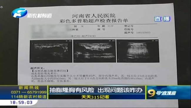 鄭州曹樂醫療整形:抽脂隆胸不靠譜 整出問題溝通難-易網健康養生網 鄭州曹樂醫療整形:抽脂隆胸不靠譜 整出問題溝通難