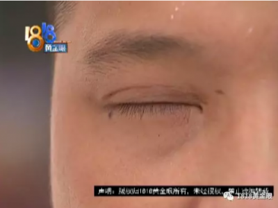 整形手術后小伙慌了！杭州靜麗醫療整形醫院：他不是我們的客戶