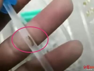 輸液管疑似有蟲 涉事廠家河南曙光健士曾因違法生產醫療器械3次被罰