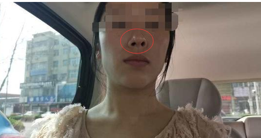 通許協(xié)和醫(yī)院醫(yī)療美容科真大膽 無資質還把人給“毀容”了-易網(wǎng)<a href=http://www.jsjjzhkt.cn/ target=_blank class=infotextkey>健康養(yǎng)生</a>網(wǎng) 通許協(xié)和醫(yī)院醫(yī)療美容科真大膽 無資質還把人給“毀容”了