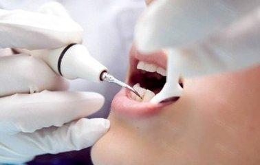 杭州美奧口腔怎么樣?洗牙能去除煙漬嗎-易網健康養生網 杭州美奧口腔怎么樣?洗牙能去除煙漬嗎