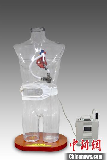 四川開展國內首例正式上市人工心臟植入手術