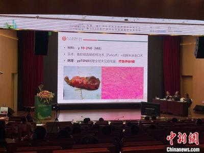 中國結(jié)直腸癌高發(fā) 專家指出不能忽略指檢