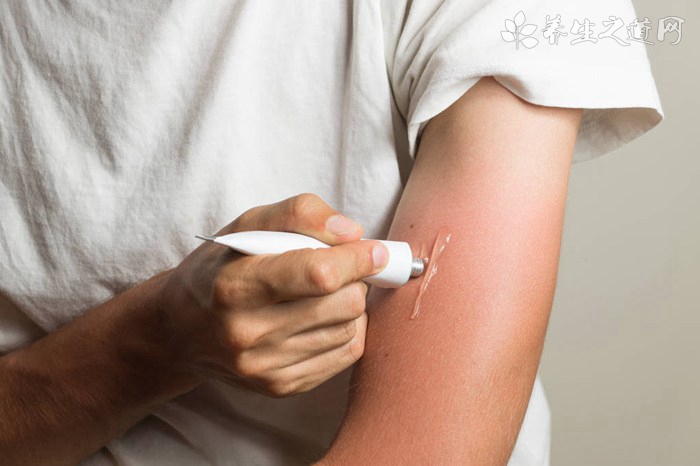 村民被紅火蟻咬后休克 被紅火蟻咬怎么辦-易網<a href=http://www.jsjjzhkt.cn/ target=_blank class=infotextkey>健康養生</a>網 村民被紅火蟻咬后休克 被紅火蟻咬怎么辦