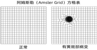 102歲老人突然眼盲后重獲光明 看清人臉時連稱活著有勁了-易網(wǎng)健康<a href=http://www.jsjjzhkt.cn/jkys/ target=_blank class=infotextkey>養(yǎng)生</a>網(wǎng) 102歲老人突然眼盲后重獲光明 看清人臉時連稱活著有勁了