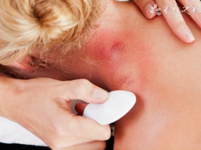 趙明國攜手諾貝爾獎得主 共談白癜風診療新趨勢