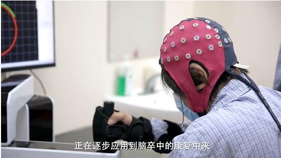 急救、治療、康復,全面打響腦卒中“反擊戰”-易網健康養生網 急救、治療、康復,全面打響腦卒中“反擊戰”