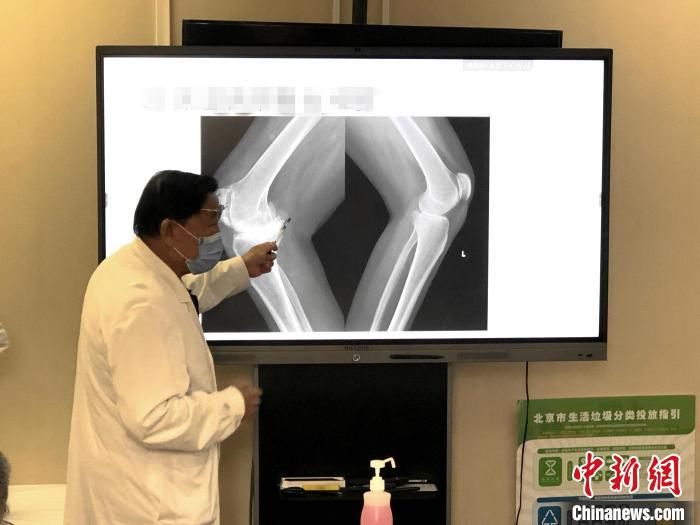 大骨節病公益項目：已為西藏244位大骨節病患者進行關節置換手術