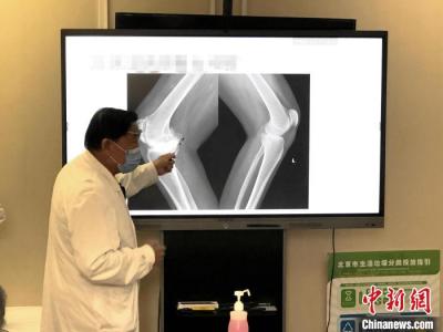 大骨節病公益項目：已為西藏244位大骨節病患者進行關節置換手術