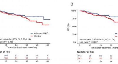 廣東團隊證實新型化療方案可降低肝細胞癌患者術后復發風險
