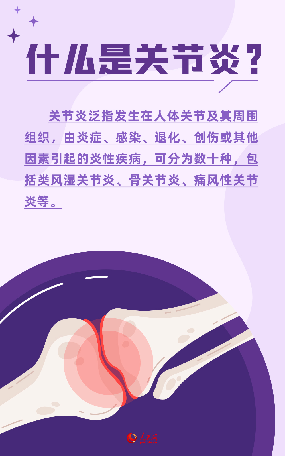 世界關(guān)節(jié)炎日:警惕!關(guān)節(jié)最怕這5件事兒-易網(wǎng)健康<a href=http://www.jsjjzhkt.cn/jkys/ target=_blank class=infotextkey>養(yǎng)生</a>網(wǎng) 世界關(guān)節(jié)炎日:警惕!關(guān)節(jié)最怕這5件事兒