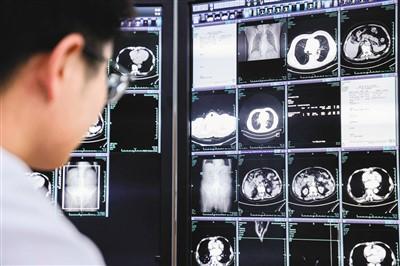 一次平掃CT 篩查多種癌癥(大健康觀察)