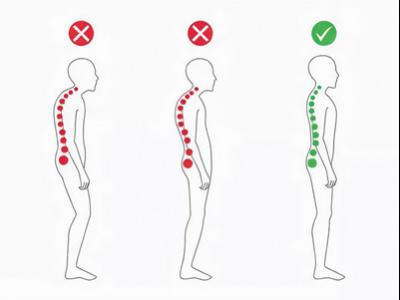 不良體態正悄悄損害你的健康（服務窗）
