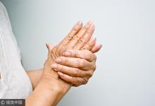 喝水加它竟能防痛風？尿酸高牢記6大飲食禁忌可保命！