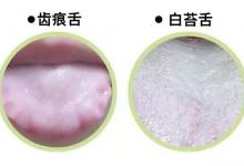 每天蒸飯放一把，遠離三高、心臟病、拒絕癌癥